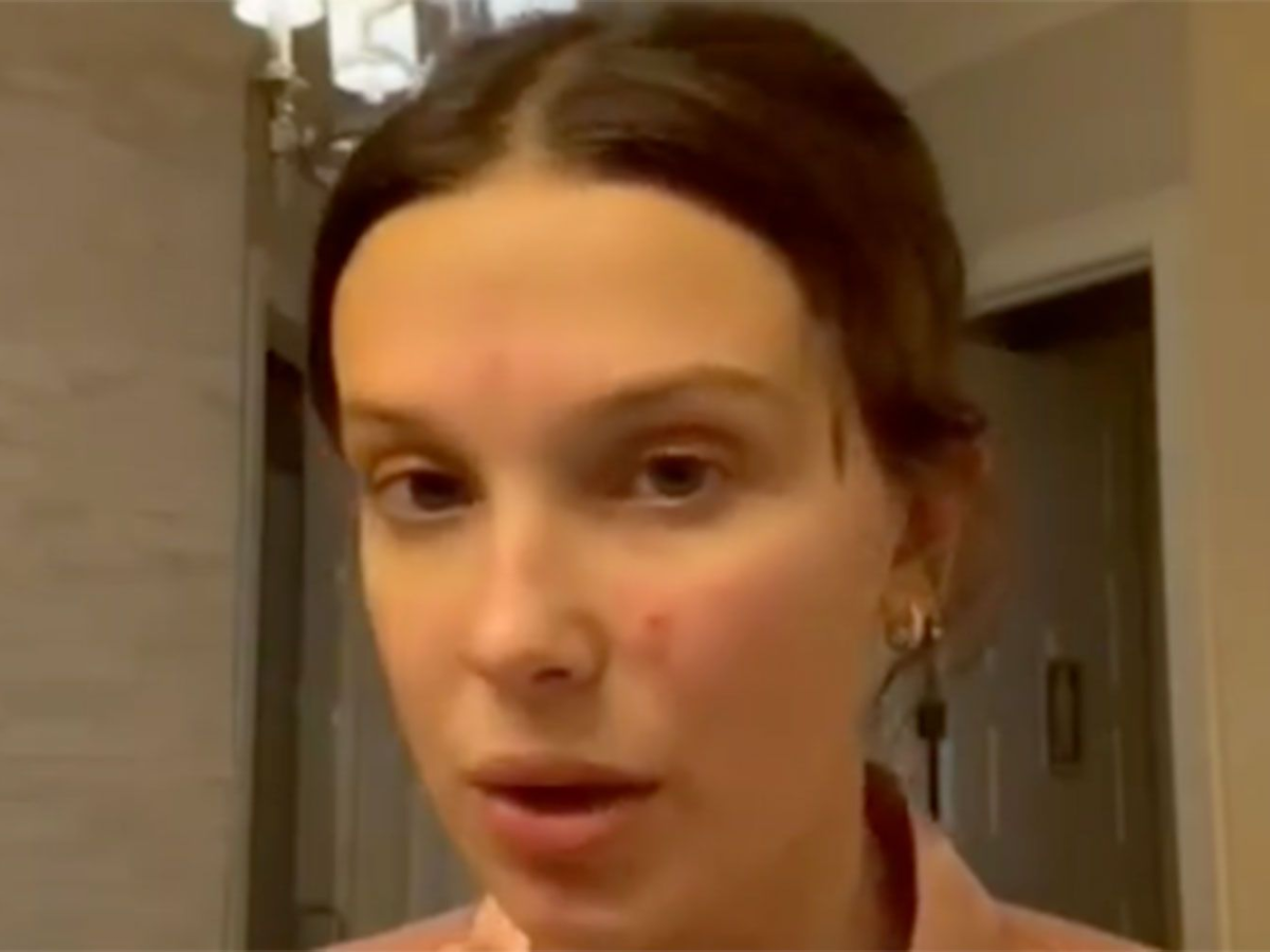 Millie Bobby Brown reveals acne skin, asking for help - no makeup